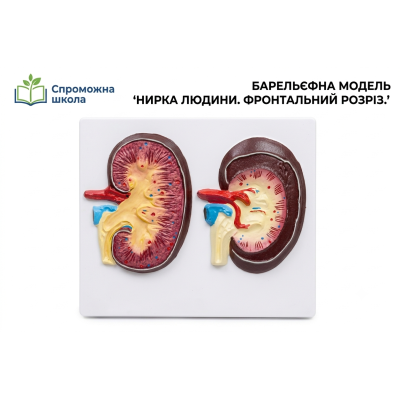 Барельєфна модель "Нирка людини. Фронтальний розріз" для навчання
